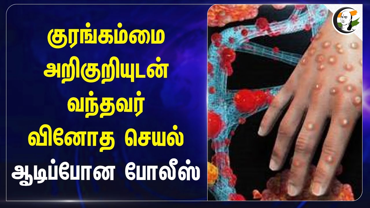 Monkey Pox அறிகுறியுடன் வந்தவர் வினோத செயல்.. ஆடிப்போன Police | Trichy