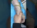 Intramuscular Injection Technique Explained | Safe IM Injection Step-by-Step | Nurse Guide Class 16