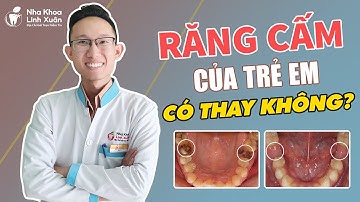 Răng cấm của trẻ có thay không? Sâu răng cấm phải làm sao?