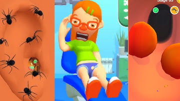 Earwax Clinic Game 3D New Max Level Gameplay Walkthrough Update Trailer iOS, Android Mobile Game