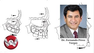 How a patient with a class I growth pattern develops