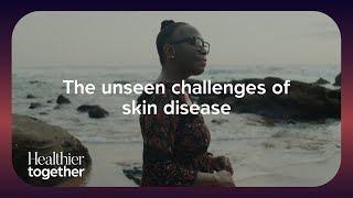 The unseen challenges of skin disease | Recognising the impact of skin health