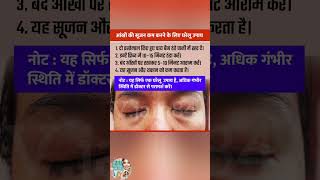 Eye Swelling Home Remedies | आंखों की सूजन कम करने का आसान तरीका #shorts #vjain84 #puffyeyes #skin