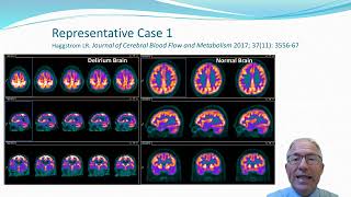 Download Lagu WDAD 2022 - What is delirium? MP3