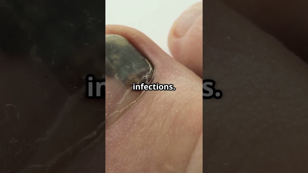 Unlock the Secret to Healthy Nails with Metanail Complex.  #shorts #shortvideo #nails