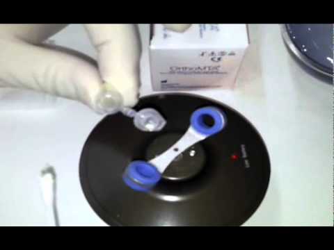 OrthoMTA - BioFilling Technique with OrthoMTA.mpg