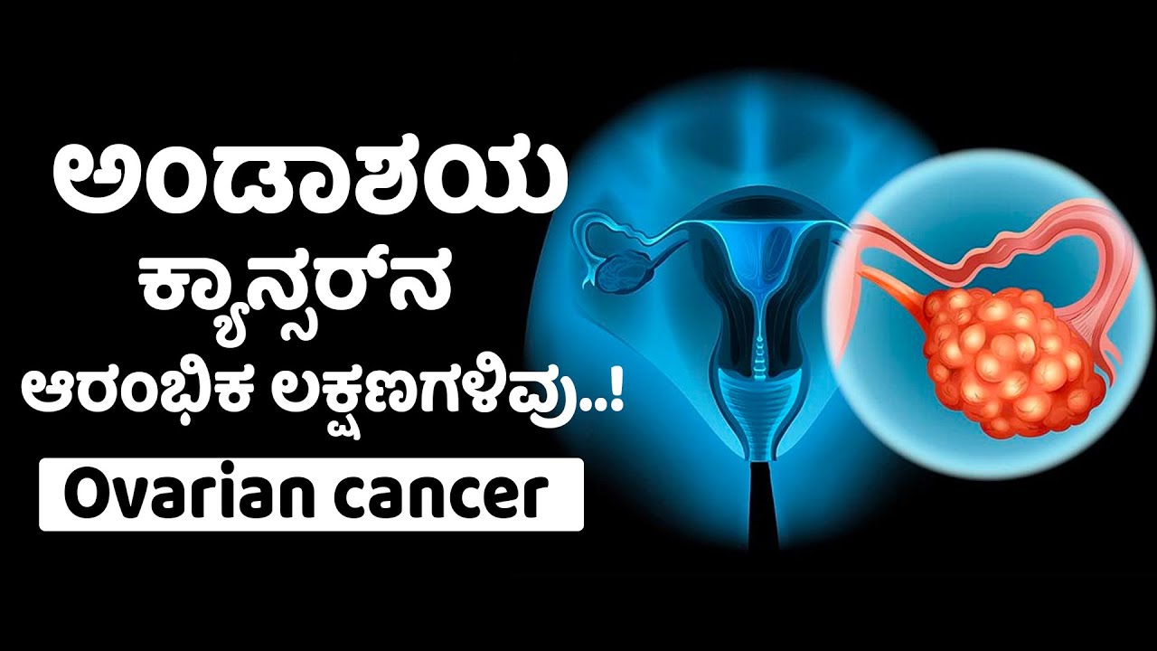 Ovarian Cancer - Symptoms and Causes | ಅಂಡಾಶಯ ಕ್ಯಾನ್ಸರ್‌ ಬಗ್ಗೆ ನಿಮಗೇನು ಗೊತ್ತು? | Vijay Karnataka