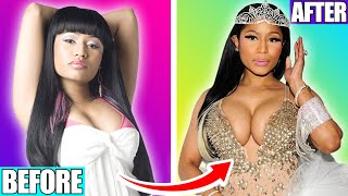 Nicki Minaj Before And After The Surgery Nicki Minaj Before And After The Surgery