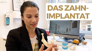 Was kostet Implantat 1 Zahn?