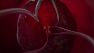 Stryker Neurovascular   YouTube   Google Chrome 2019 05 27 15 08 42
