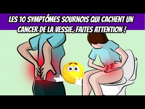 Vidéo: Trabéculation De La Vessie: Traitements, Causes, Symptômes