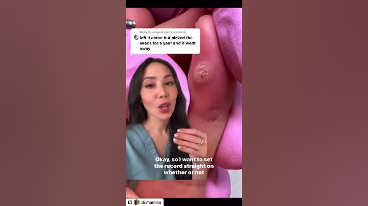 Do Warts Have Seeds?