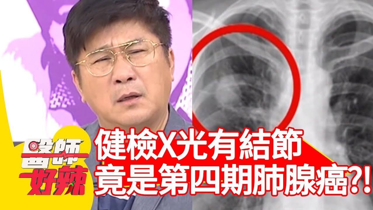 健檢X光有結節！竟是第四期肺腺癌？！【醫師好辣】 20181122  part2 EP645 曾智希 張金堅