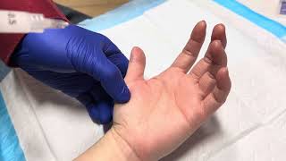 How to do trigger finger injections on the thumb