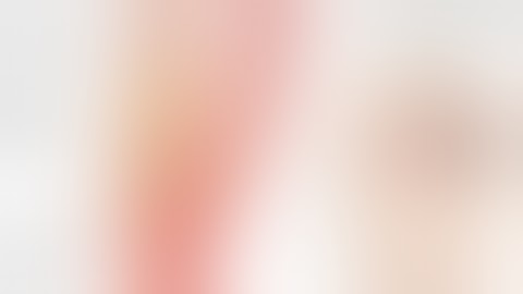 Dự phòng đột quỵ não ở bệnh hẹp động mạch cảnh