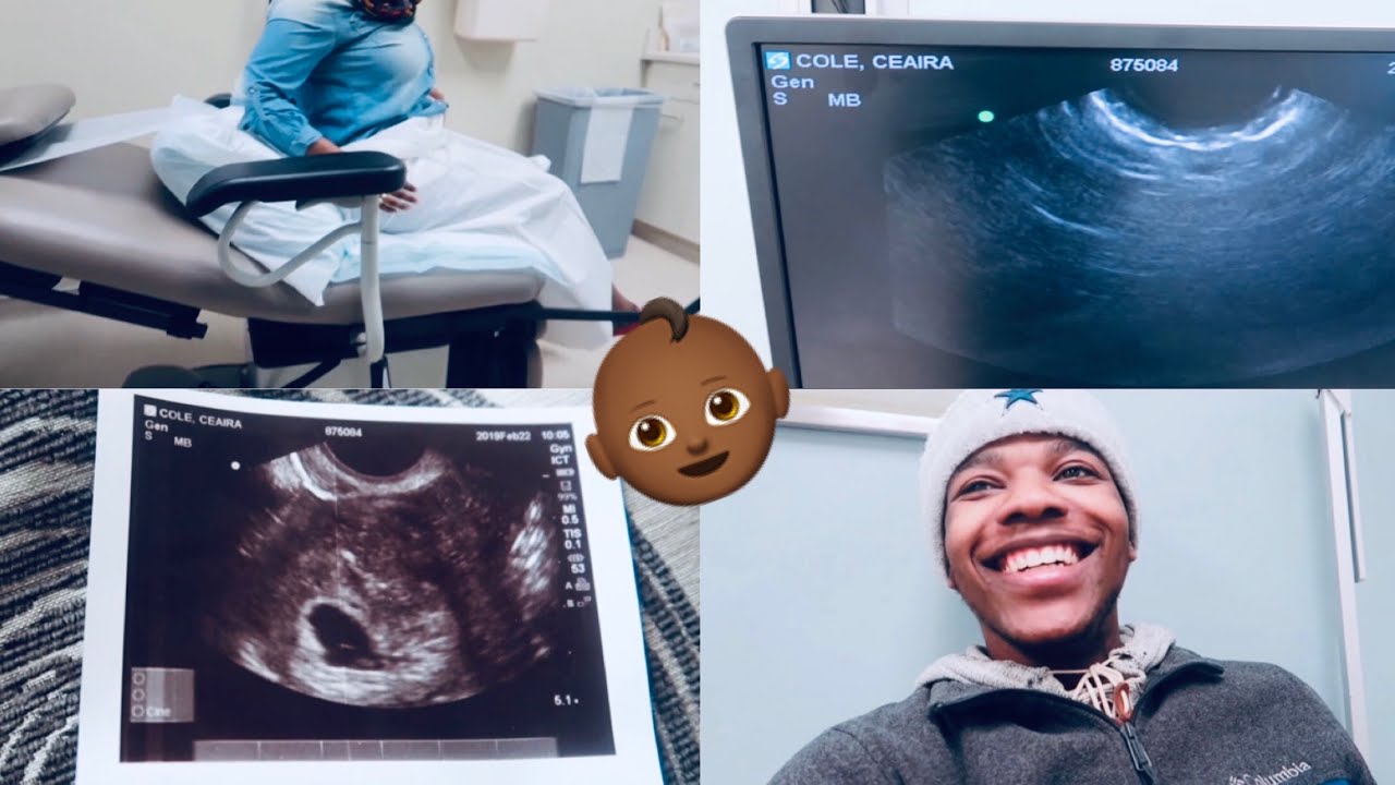 SURPRISING FIRST ULTRASOUND!! 6 WEEKS PREGNANT - YouTube