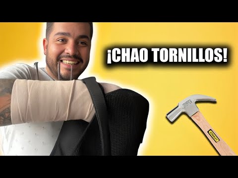 A mi primo se le cayeron los tornillos del brazo