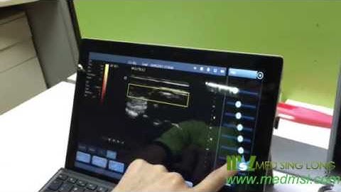 Color wireless ultrasound doppler scanner linear probe for Android tablet