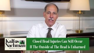 Using A Model To Explain Closed Head Injuries to the Jury – VA Attorney Richard Aufenger explains