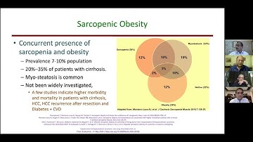 ISG MASTERCLASS I: (17) Sarcopenia in Chronic Liver Disease