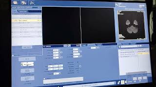 Mri 1.5T Ge software working screenshot 4