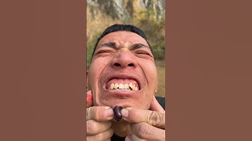 How I Cured a Bug Bite with Yogurt in the Wild | Survival Hacks