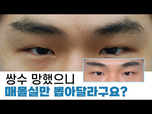 잘못된 수술 방법입니다.