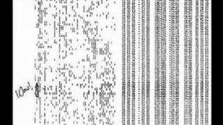 CORPUS CALLOSUM (part 1)