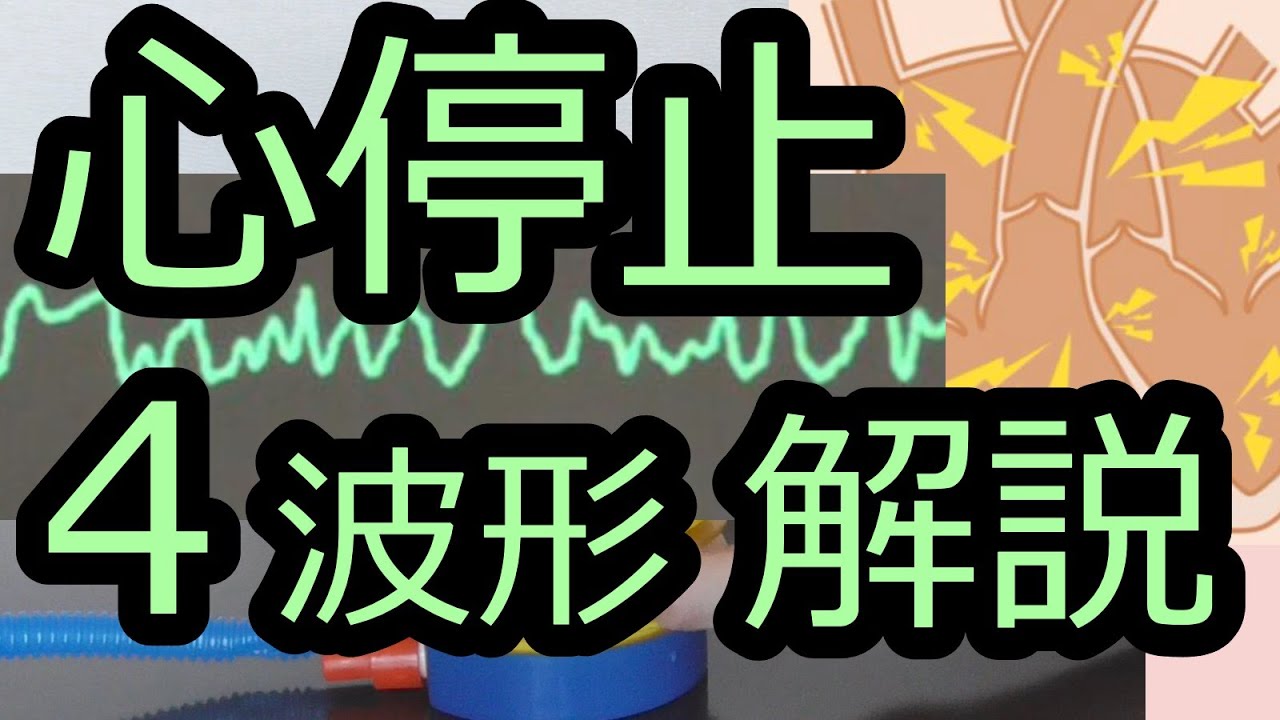 心停止波形の4種解説【ICLS、ACLS】 YouTube 心停止波形の4種解説【ICLS、ACLS】 YouTube