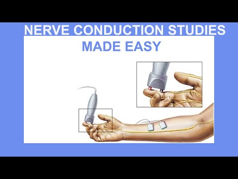 NERVE CONDUCTION STUDIES MADE EASY