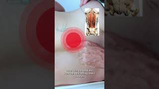 Celebrity Treating erector spinae trigger points Net Worth