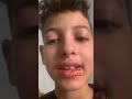 انا اضربك ألف ١٠٠٠ كف ان ان تضربني علحسبليكت انا اضربك ألف ١٠٠٠ كف ان ان تضربني علحسبليكت
