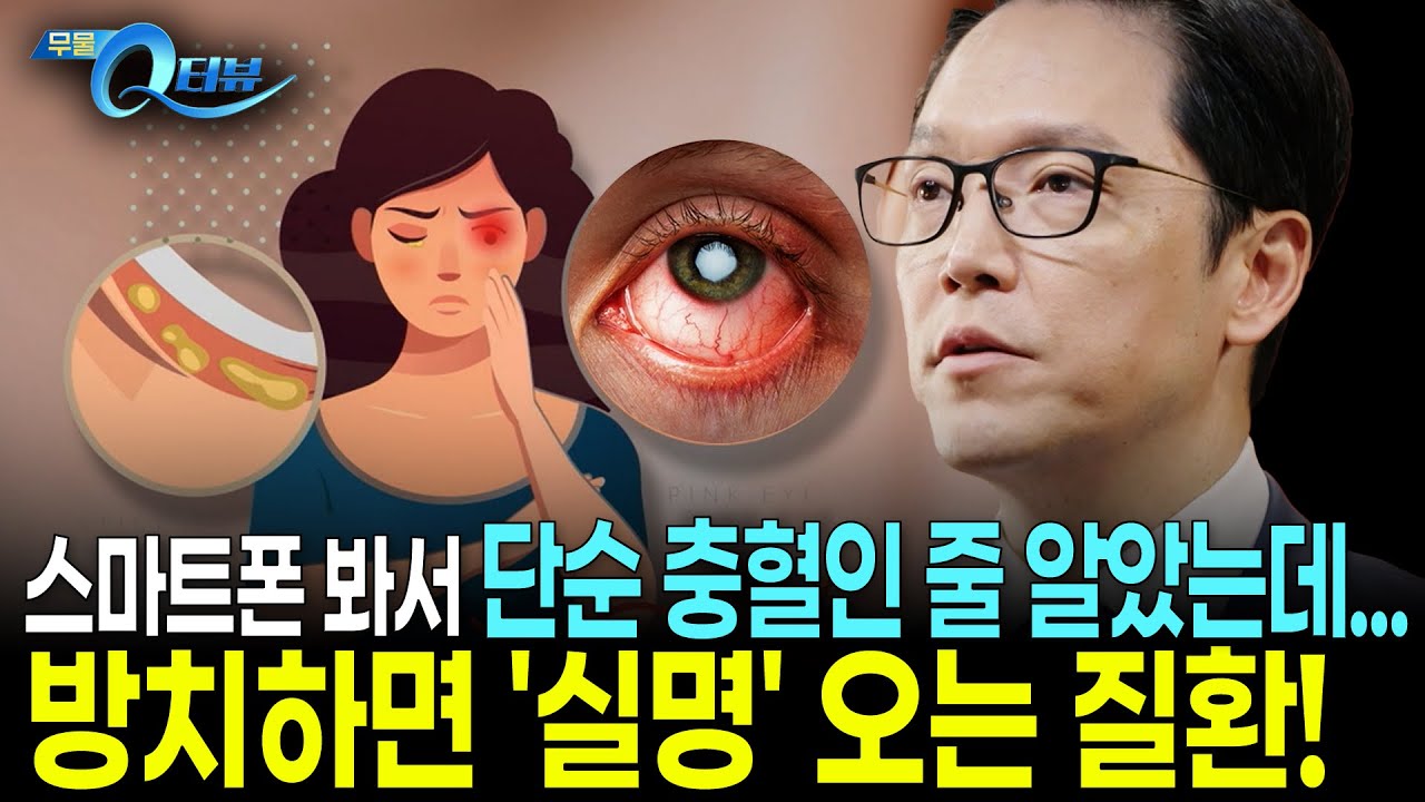 눈 속 염증을 방치하면 안되는 이유! 실명 부르는 안구 염증 질환 I 🔍Q터뷰 김민 교수 I KBS 20251215 방송
