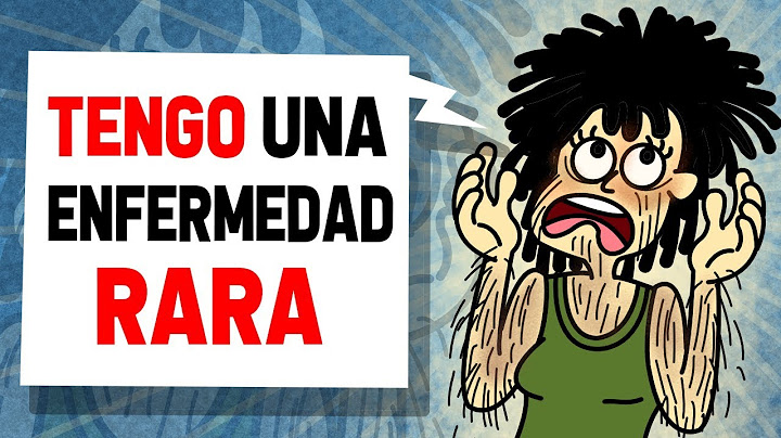 Parezco Una Mujer Lobo Y Siempre Me He Sentido Avergonzada