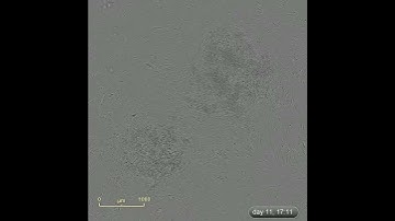 Reprogramming Human Dermal Fibroblasts to iPSCs