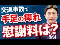 交通事故で手足がしびれた場合に慰謝料はもらえる?