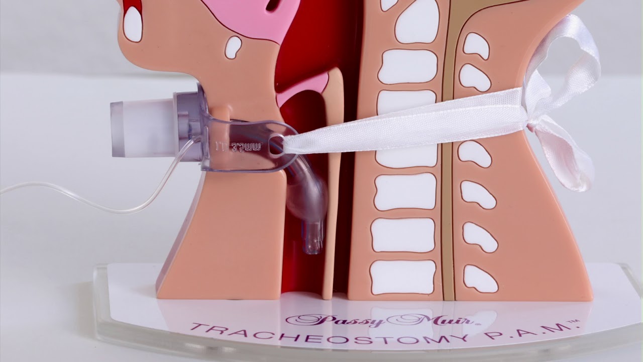 Tracheostomy PAM Cuff Inflation YouTube