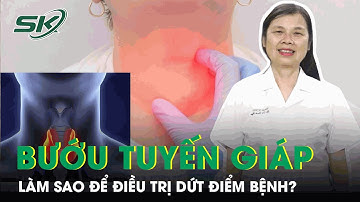 Làm Sao Để Điều Trị Dứt Điểm Bệnh Bướu Tuyến Giáp? | SKĐS