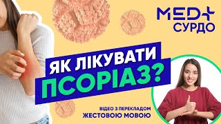 картинка: Чому виникає псоріаз? Як його лікувати? Дерматолог Наталія Ільчук. Жестовою мовою