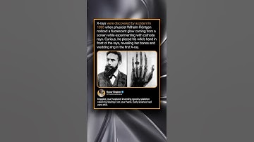X-rays were discovered by accident in 1895 when physicist Wilhelm Röntgen noticed a fluorescent glow