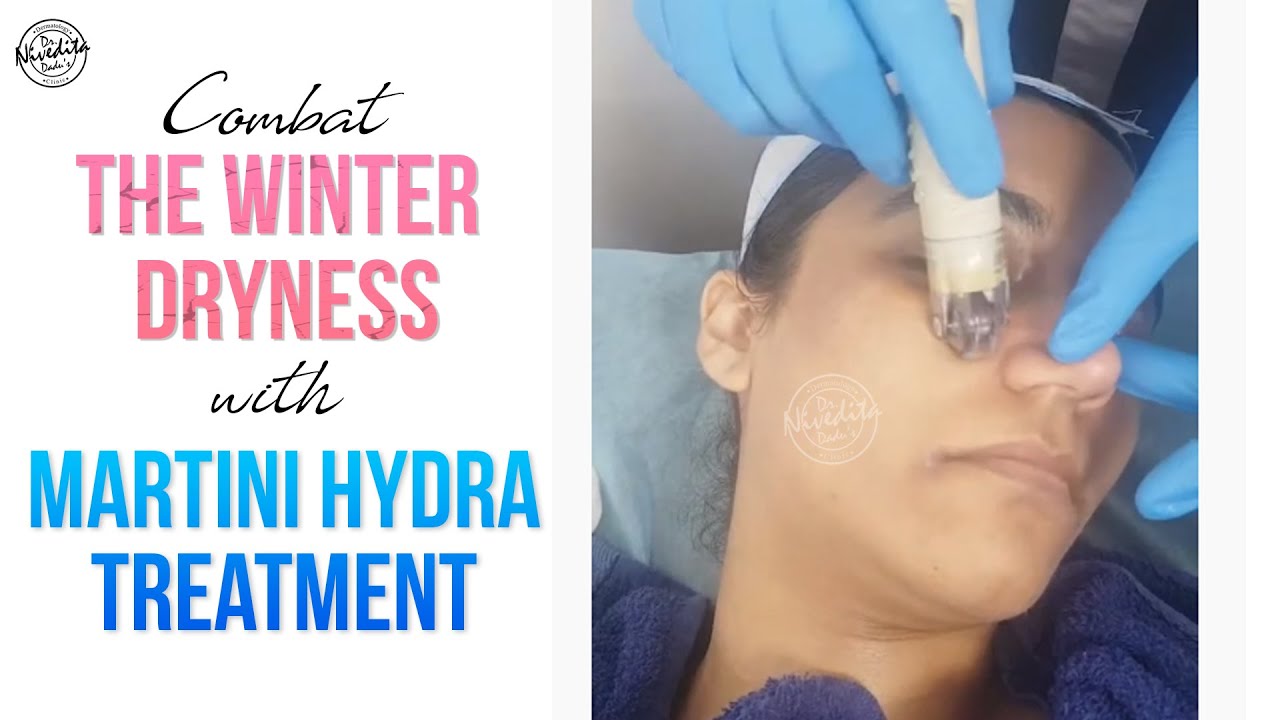 Combat The Winter Dryness With MARTINI HYDRA YouTube