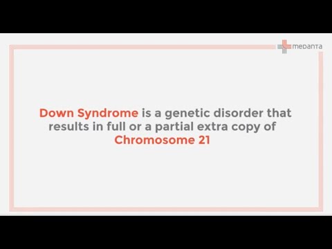 Down Syndrome: Causes,