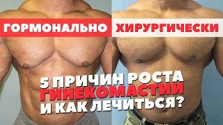 ГИНЕКОМАСТИЯ КАК ИЗБАВИТЬСЯ (Гино на Курсе ААС или подростковая)