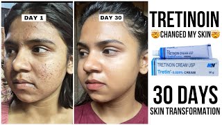 30 days skin tansformation with tretinoin | How to use tretinoin without side effects/purging screenshot 4