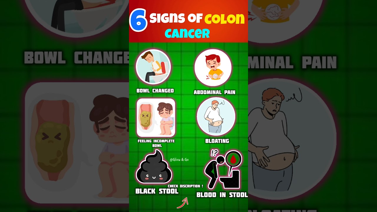 10 early signs of colon cancer That could save your life ✅ 