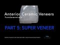 Anterior Veneers, Part 5, Super Veneer