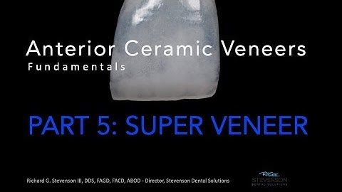 Anterior Ceramic Veneers, Part 5: Super Veneer