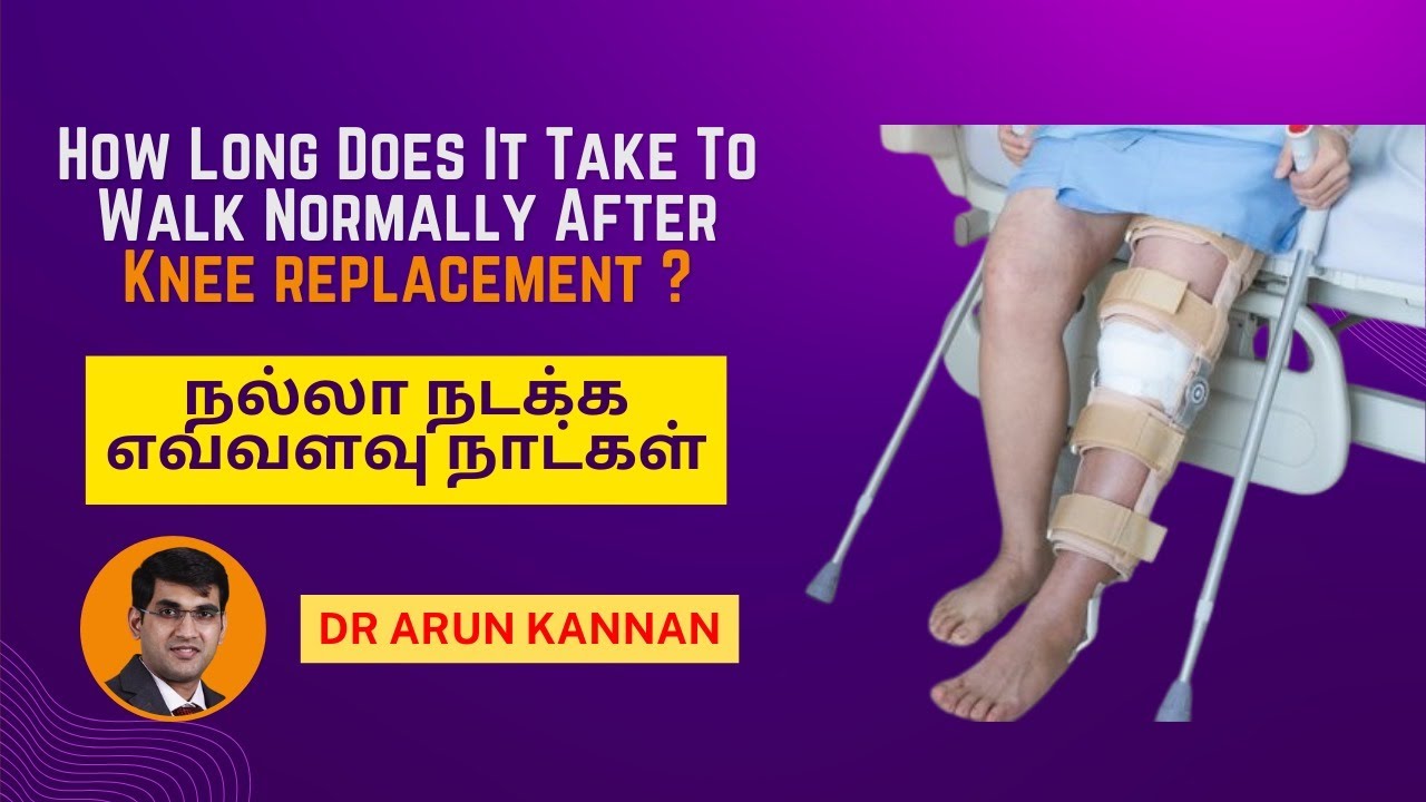 How Long Does It Take To Walk Normally After Knee replacement ? நல்லா நடக்க எவ்வளவு நாட்கள் |Dr Arun