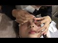Eye cleaning chinese/Eye spa/目の掃除/눈 청소【Eye ASMR】