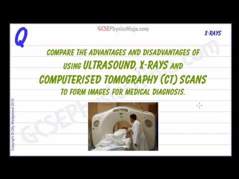 ultrasound-vs-x-ray-photography-and-ct-scans---advantages-and-disadvantages---gcse-physics